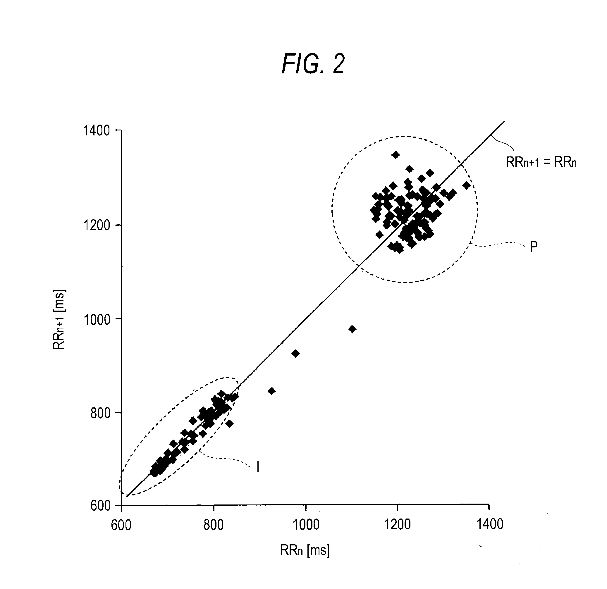 Apparatus and method for detecting epilepsy seizure