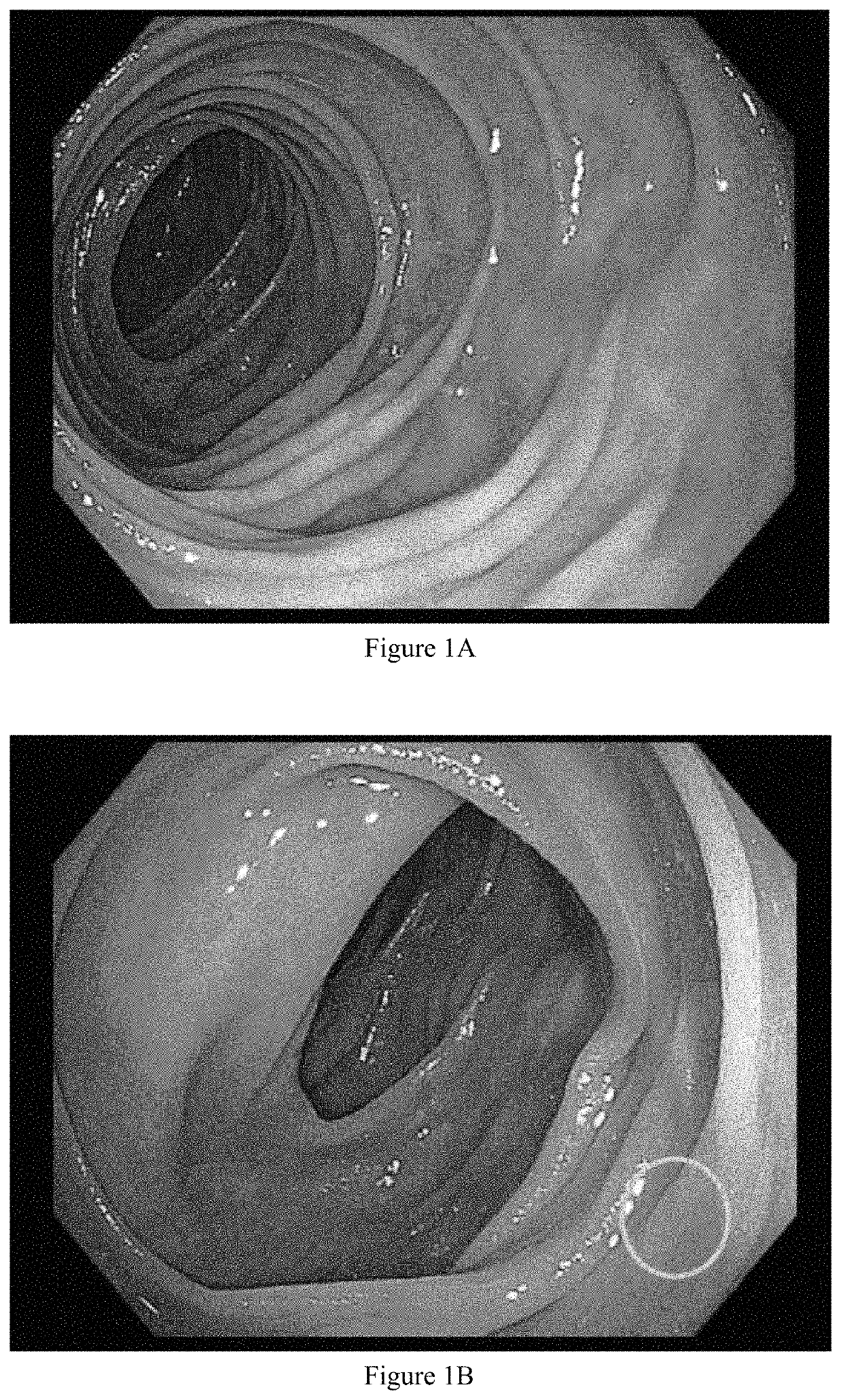 Colonic irrigation composition