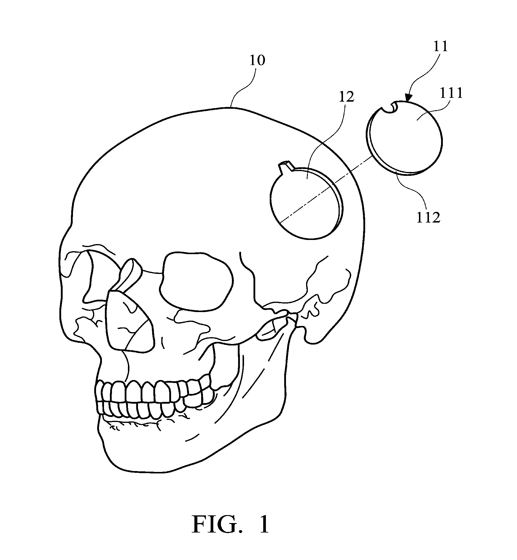 Artificial dura biomedical device and brain surgery method utilizing the same