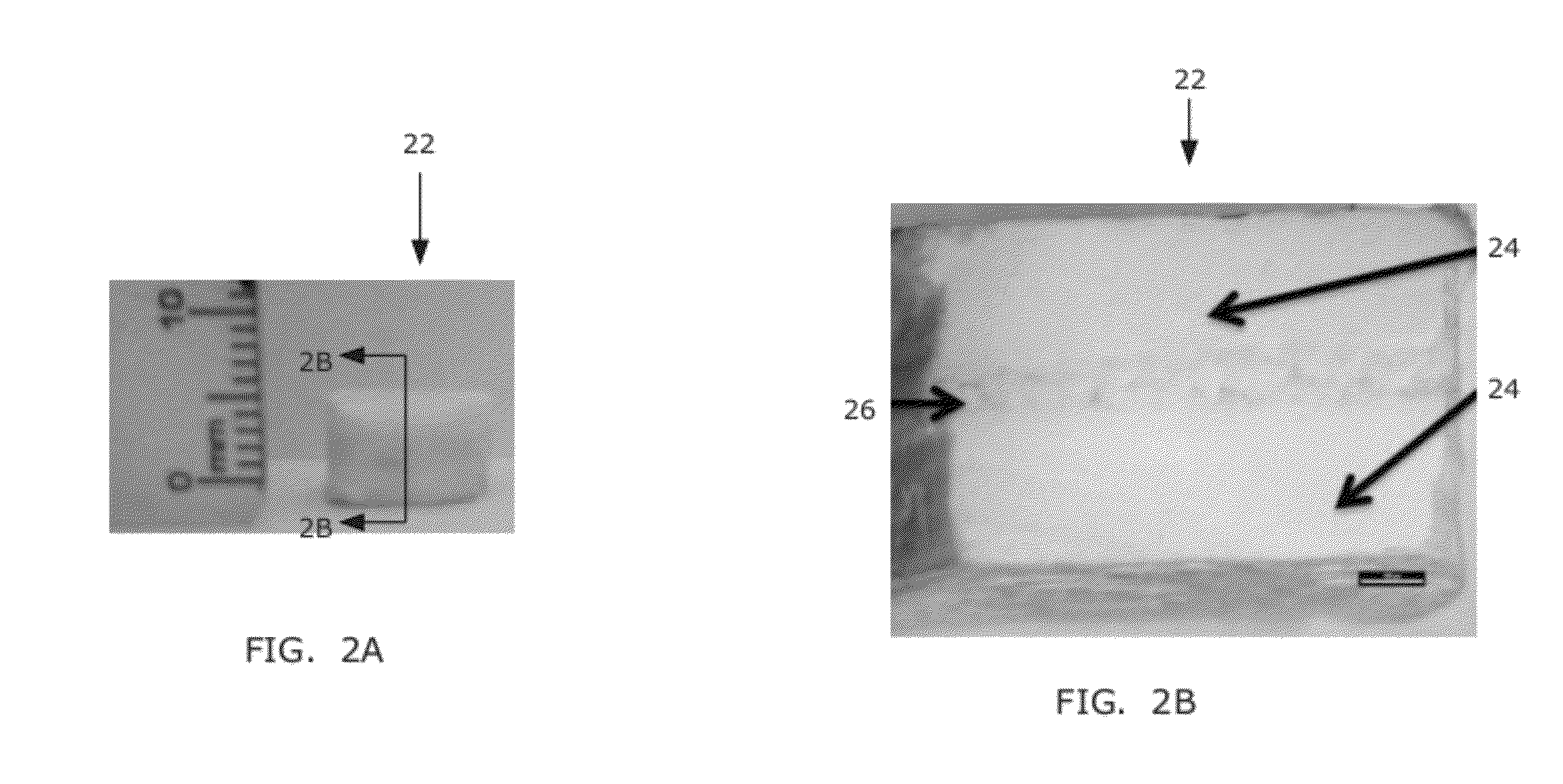 Integrated multi-zonal cage/core implants as bone graft substitutes and apparatus and method for their fabrication