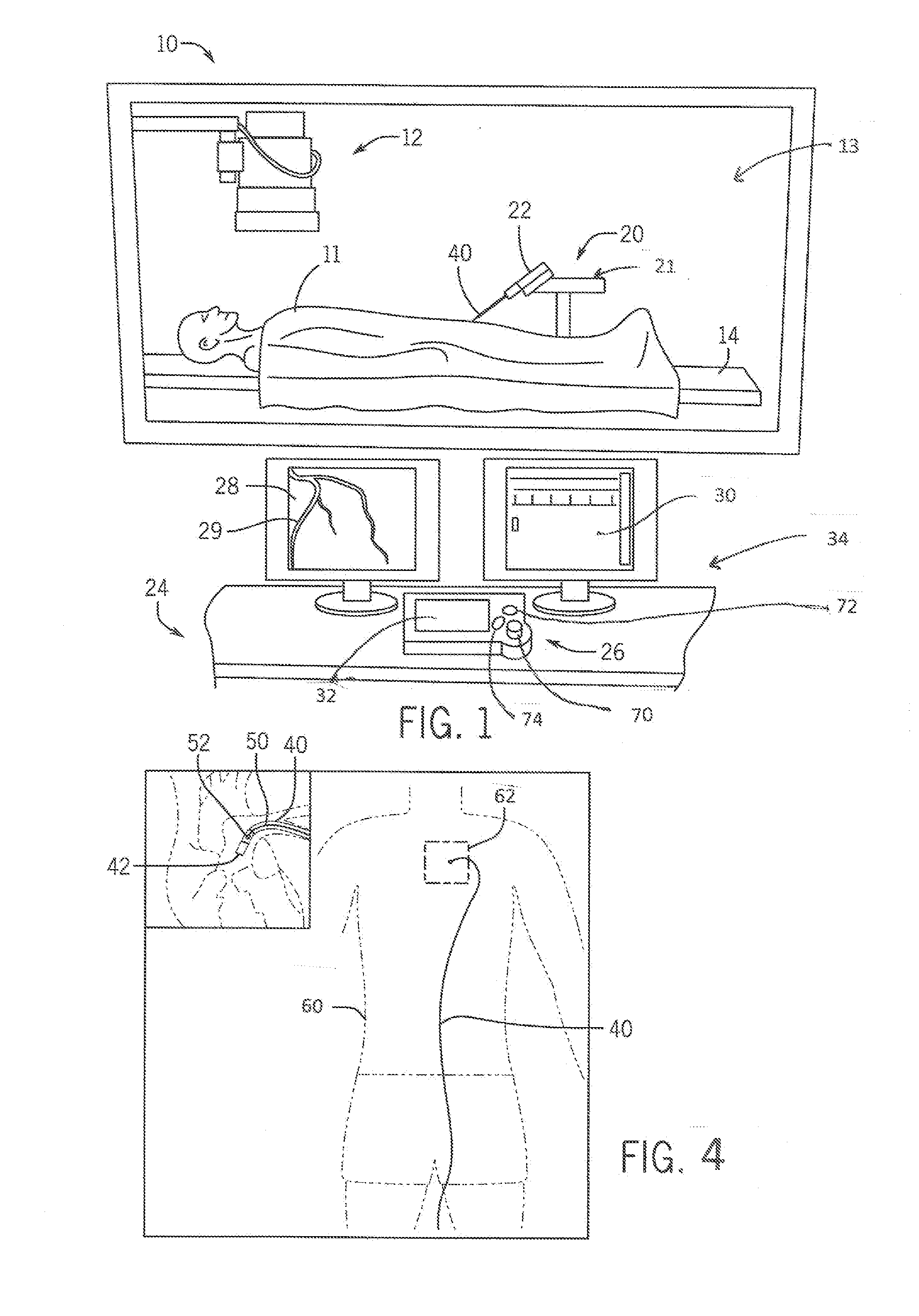 System and method for monitoring of guide catheter seating