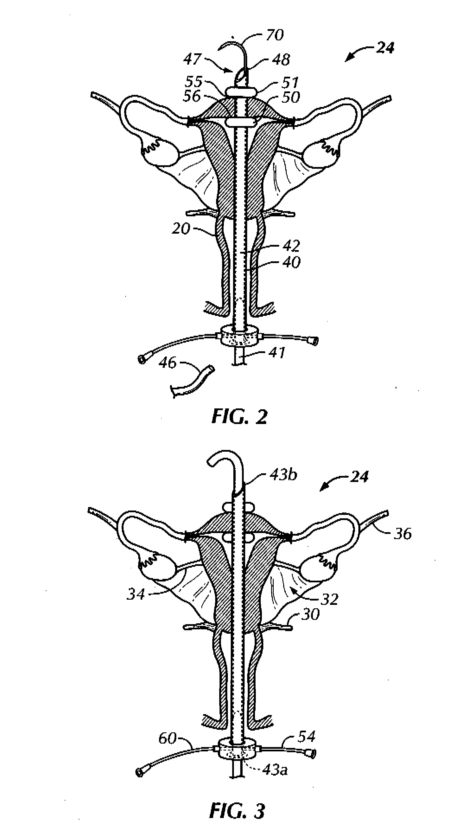 Methods and Apparatus for Natural Orifice Vaginal Hysterectomy