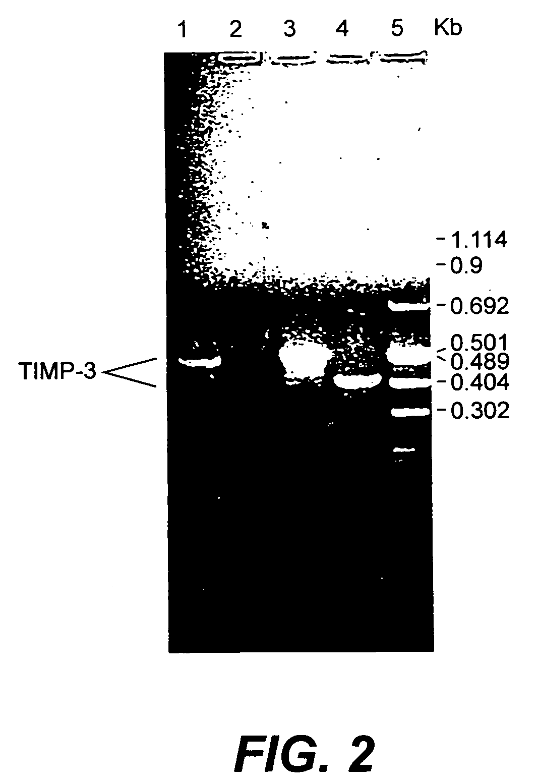 Tissue inhibitor of metalloproteinase type three (TIMP-3) composition and methods