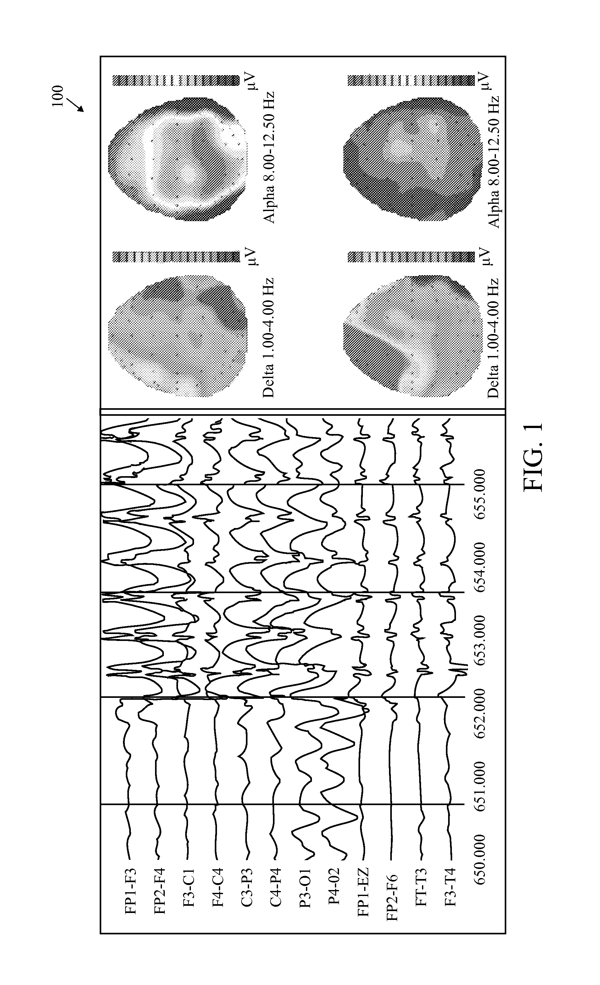 Method And System To Calculate qEEG