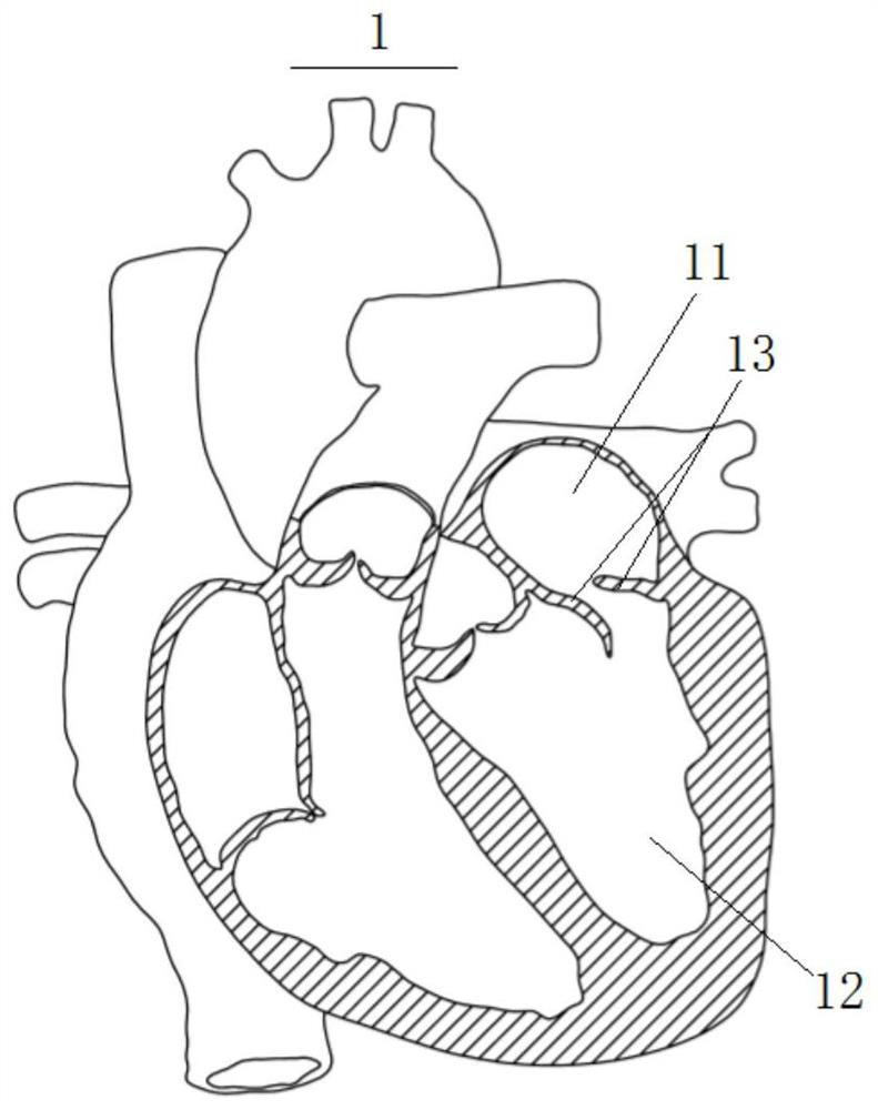 Mitral regurgitation treatment instrument