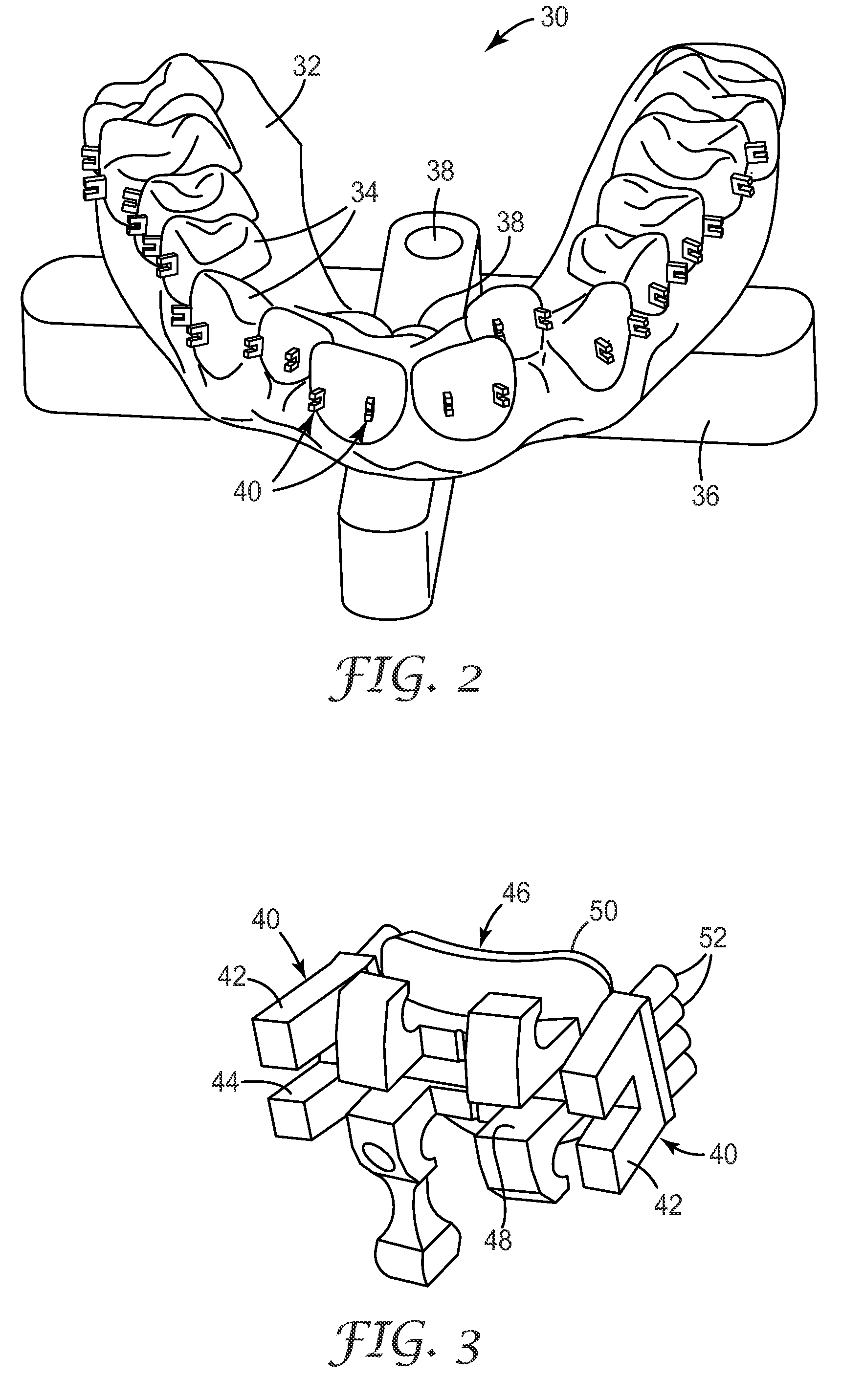 Indirect bonding trays for orthodontic treatment and methods for making the same