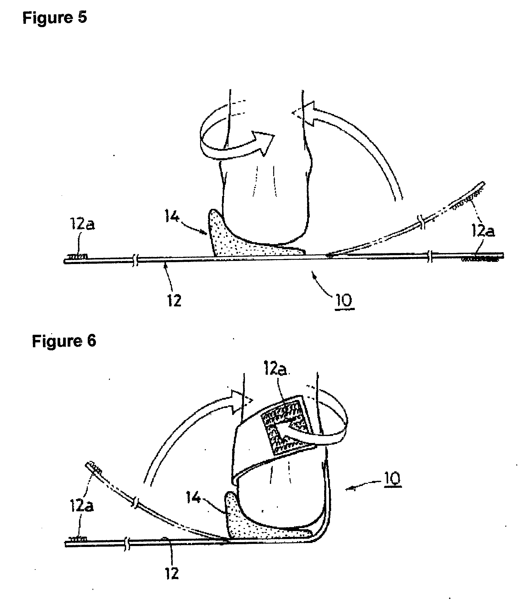 Device and method for treating arthritis of knee