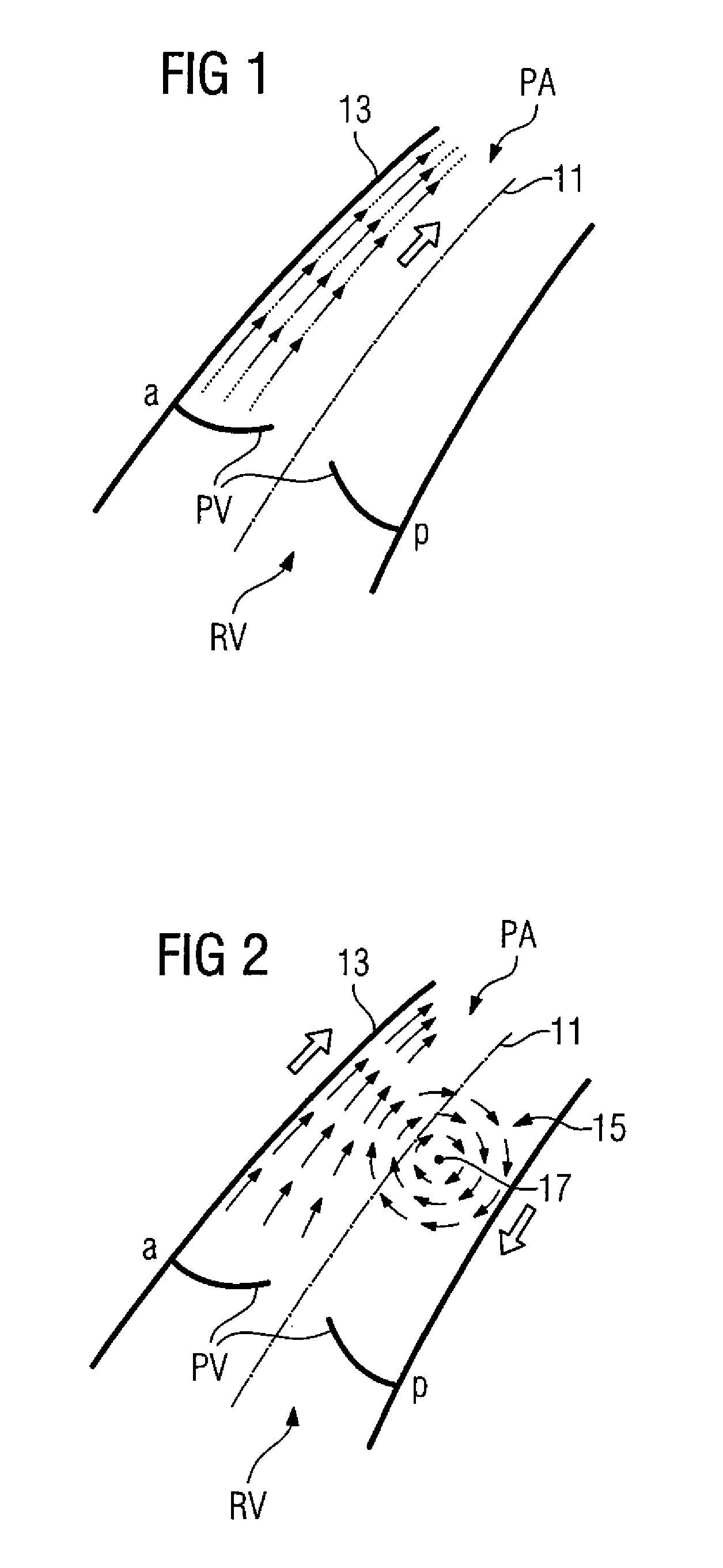 Method and medical apparatus for measuring pulmonary artery blood flow
