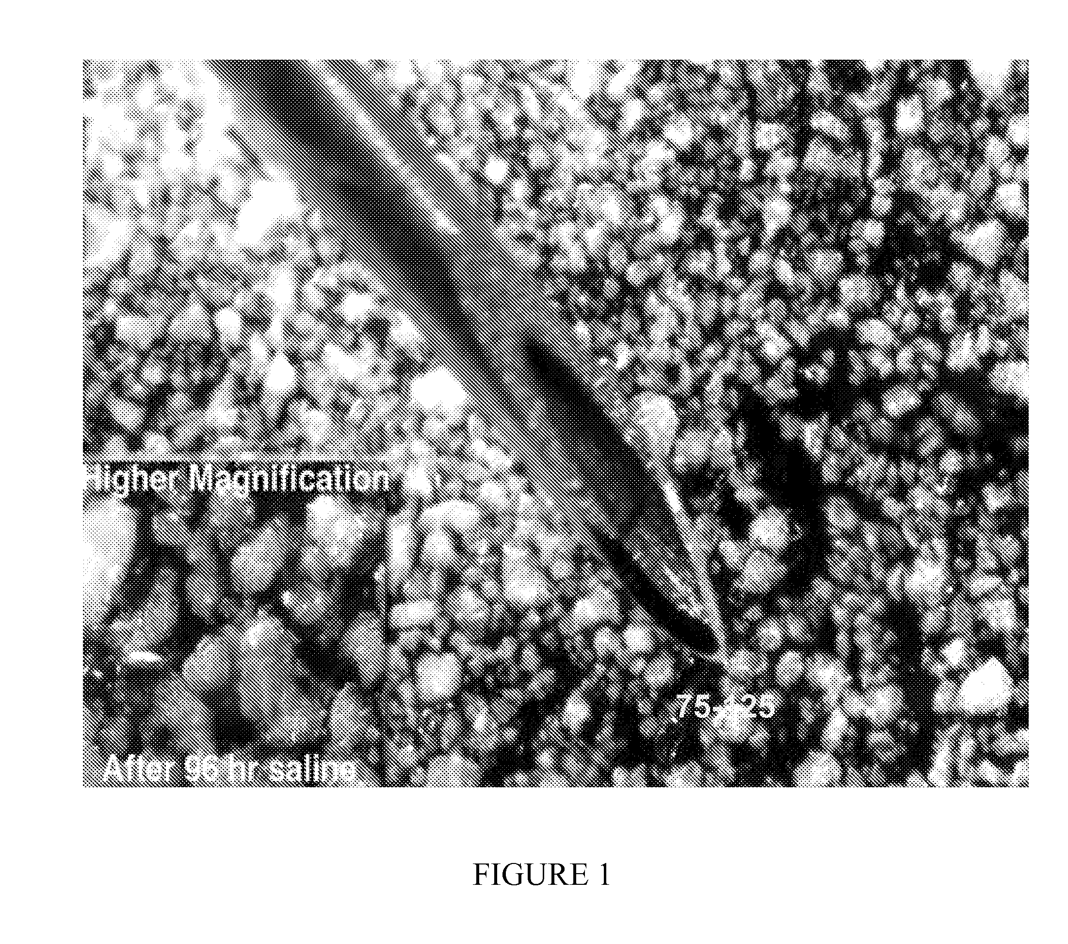Biocompatible protein-based particles and methods thereof