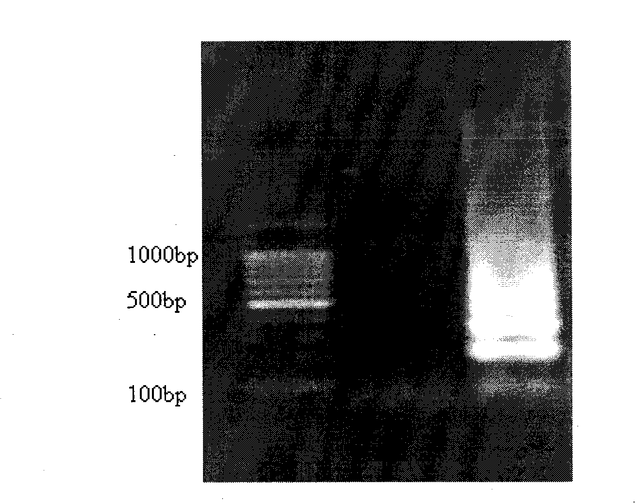 Reagent kit and method for detection of artificial tuberculosis yersinia genus with ring mediated isothermality amplification method