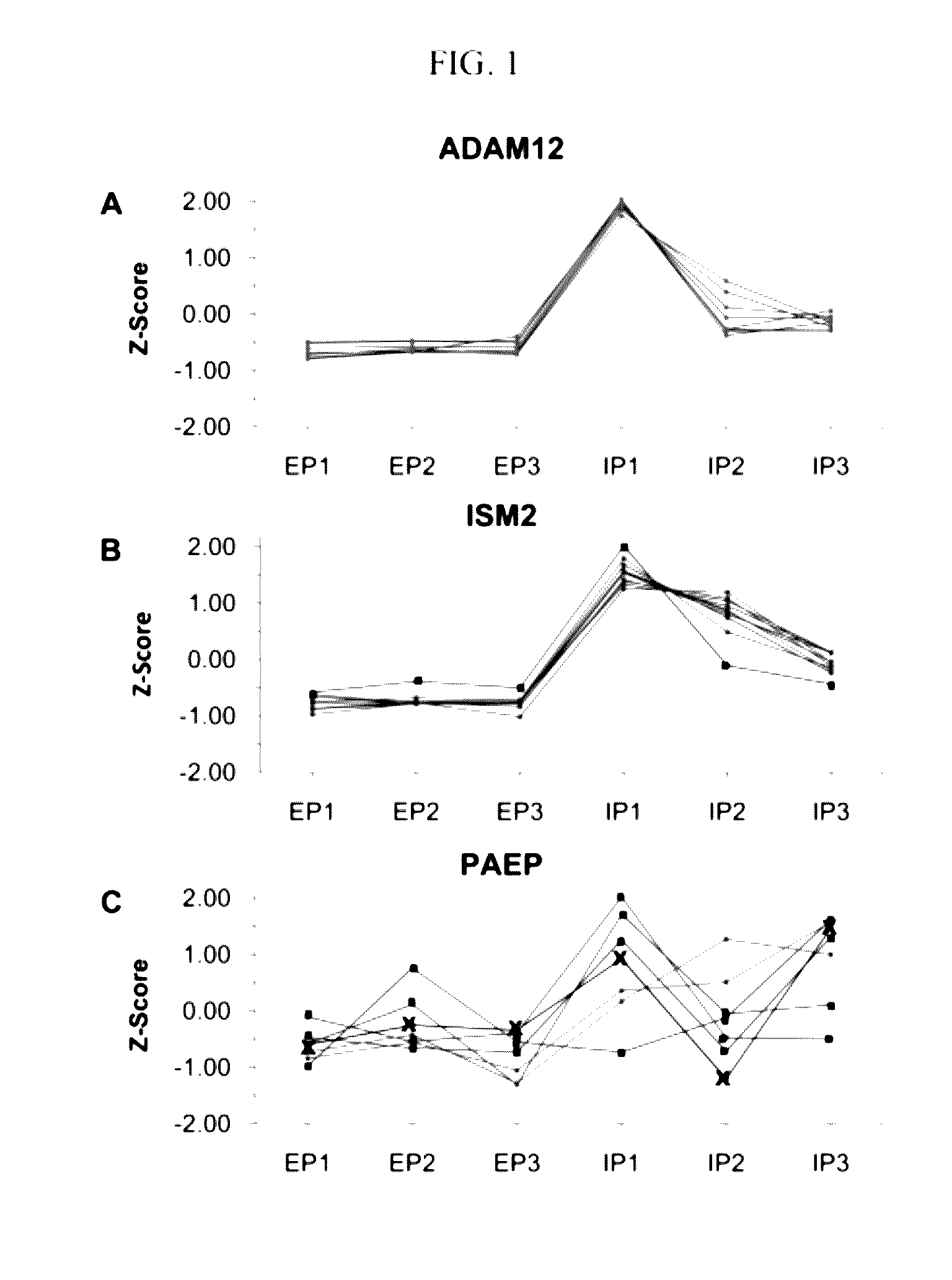 Methods and compositions for diagnosis of ectopic pregnancy