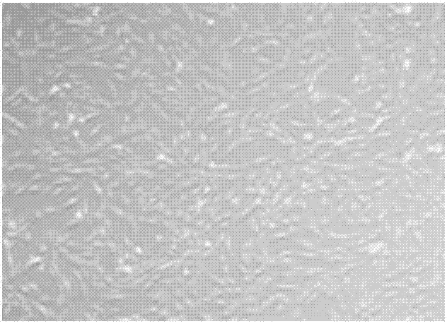 Endometrial stem cell preparation and application thereof