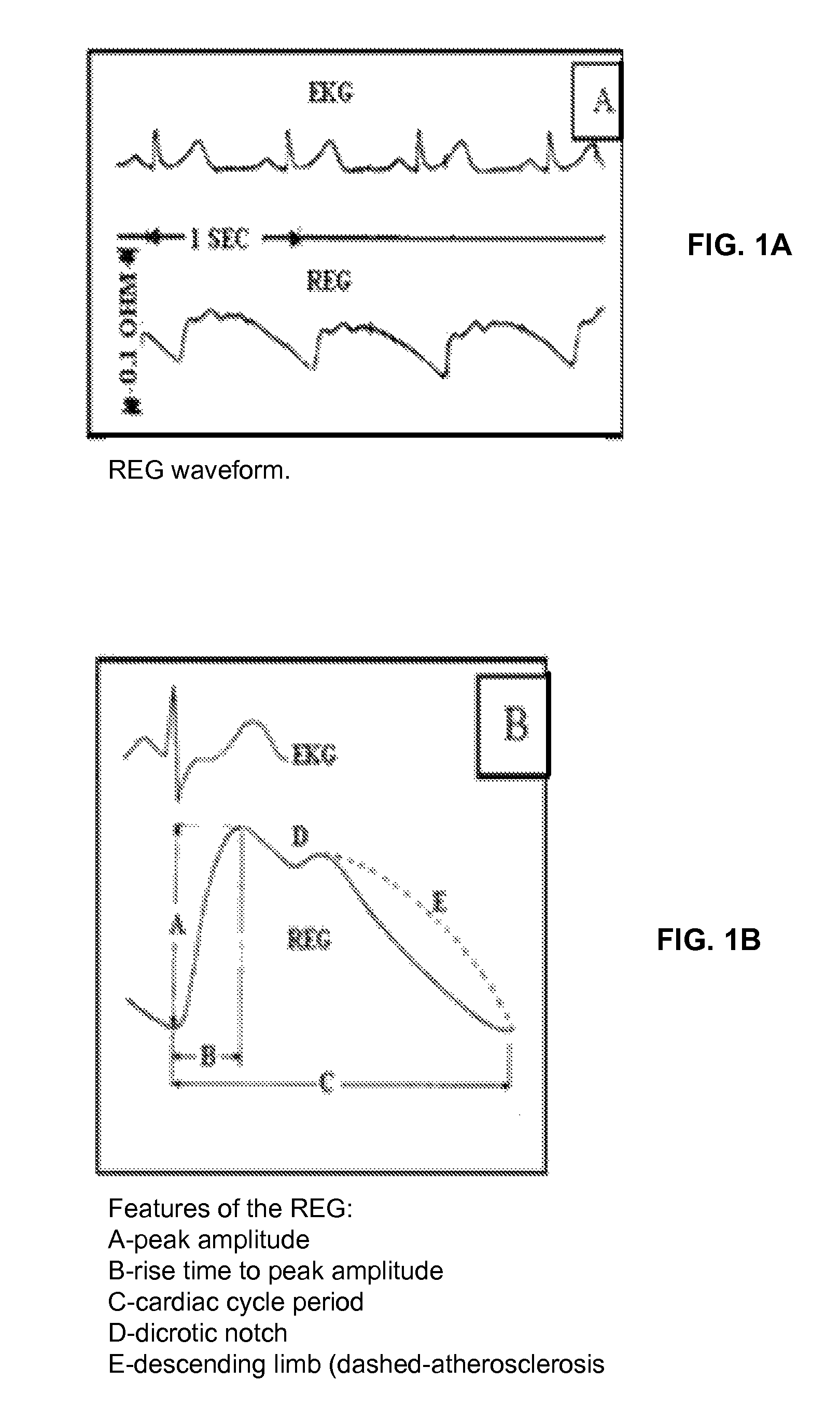 Method and apparatus for non-invasive assessment of hemodynamic and functional state of the brain