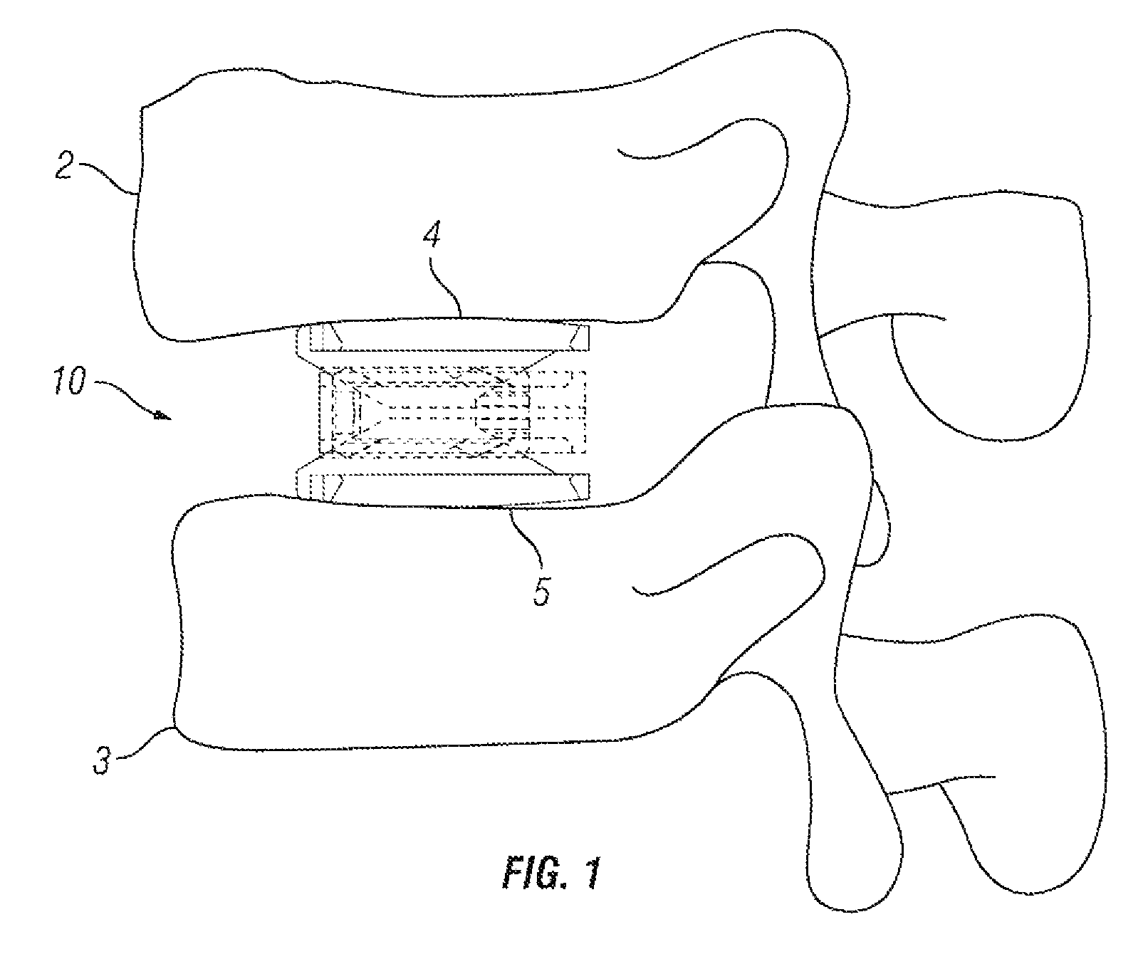 Expandable fusion device and method of installation thereof