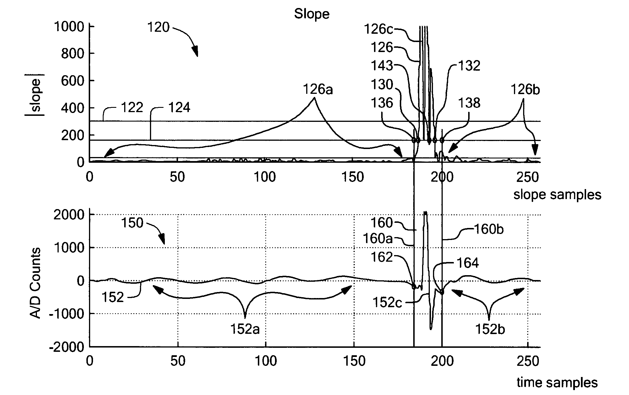 System and method for reducing a radar interference signal