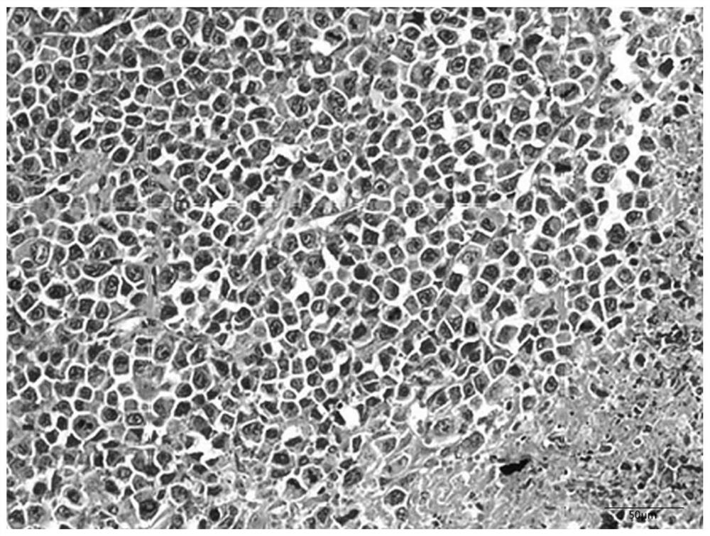 Anti-tumor multi-strain fermentation product and preparation method thereof