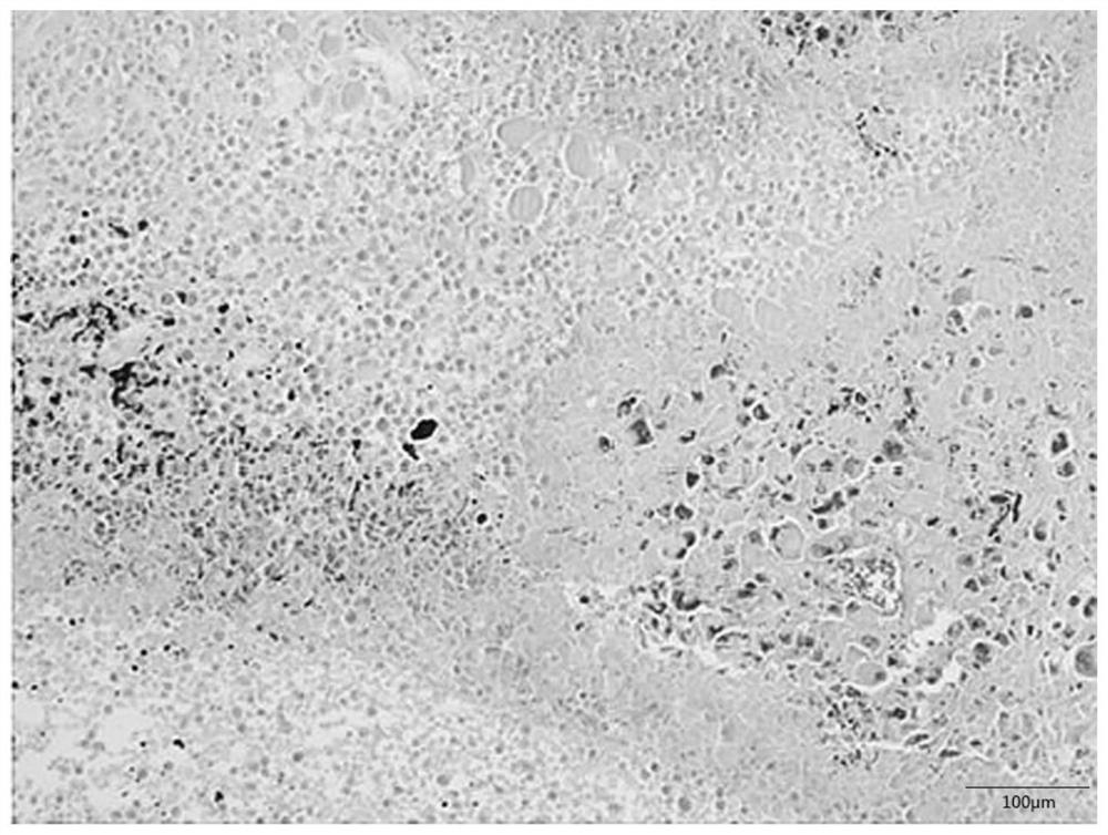 Anti-tumor multi-strain fermentation product and preparation method thereof