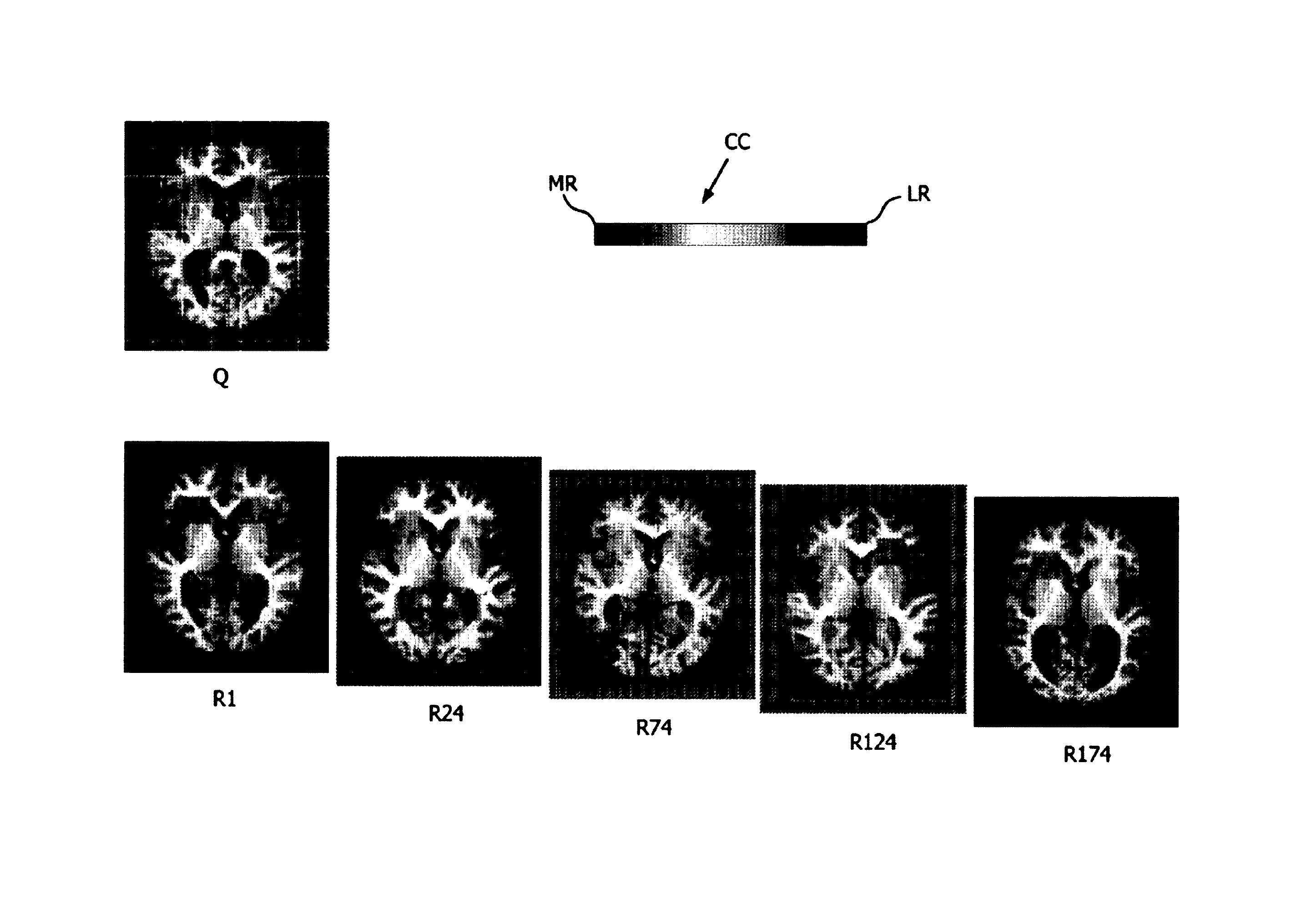 Visualization of relevance for content-based image retrieval