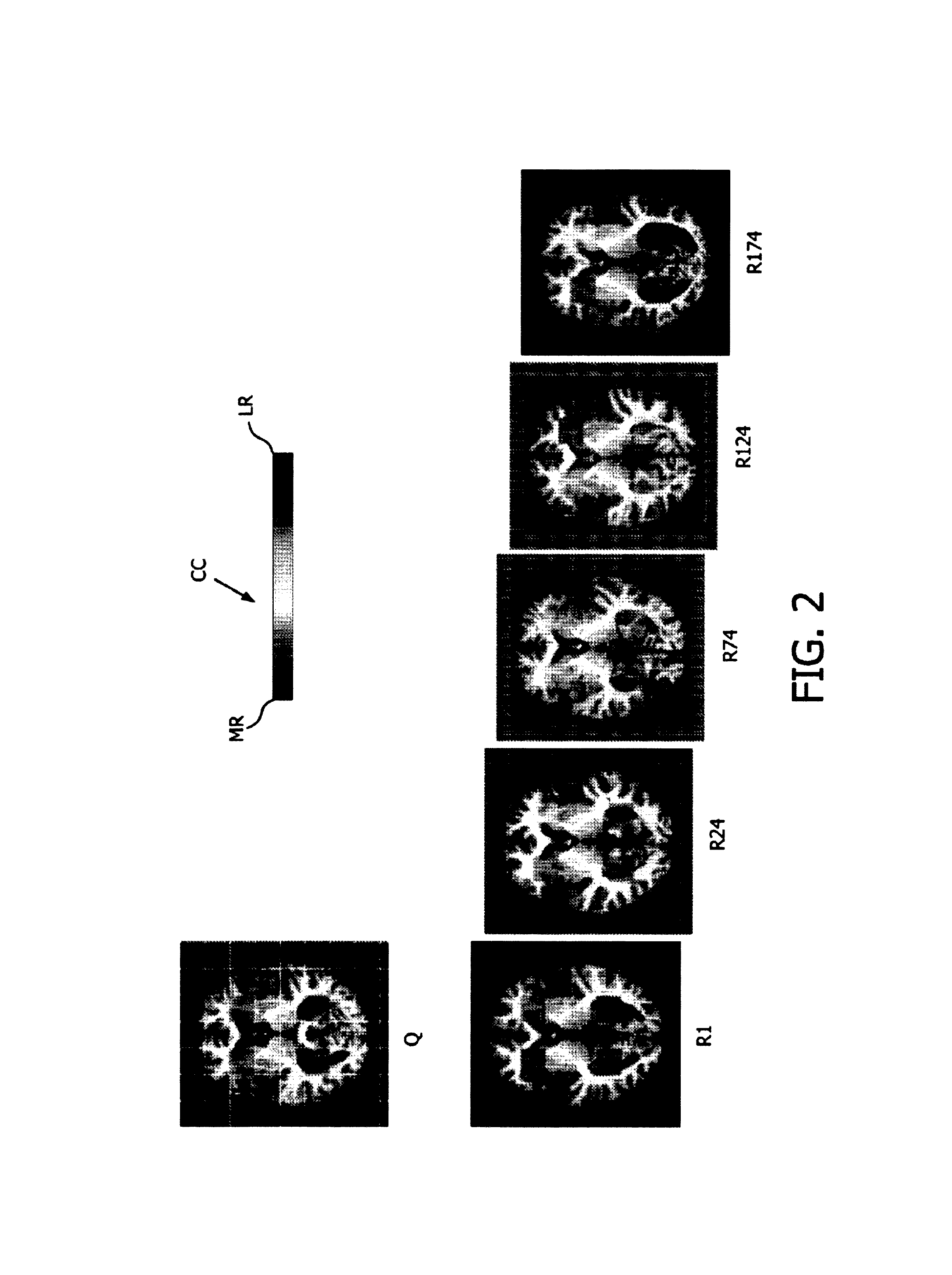 Visualization of relevance for content-based image retrieval