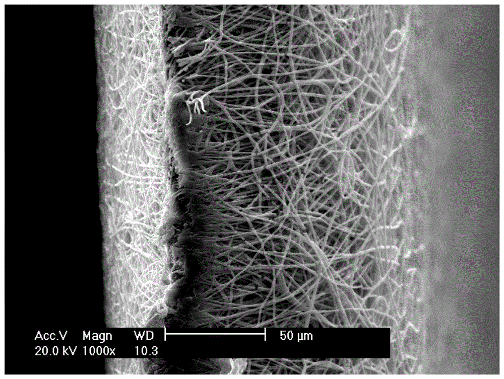 Implanted fibrous membrane for repairing pelvic floor dysfunctional disease, preparation method and medical device containing same