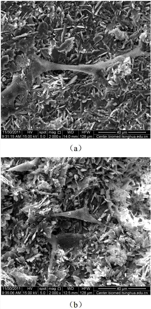 Anti-infection mineralized collagen and calcium sulfate bone repair material and preparation method thereof