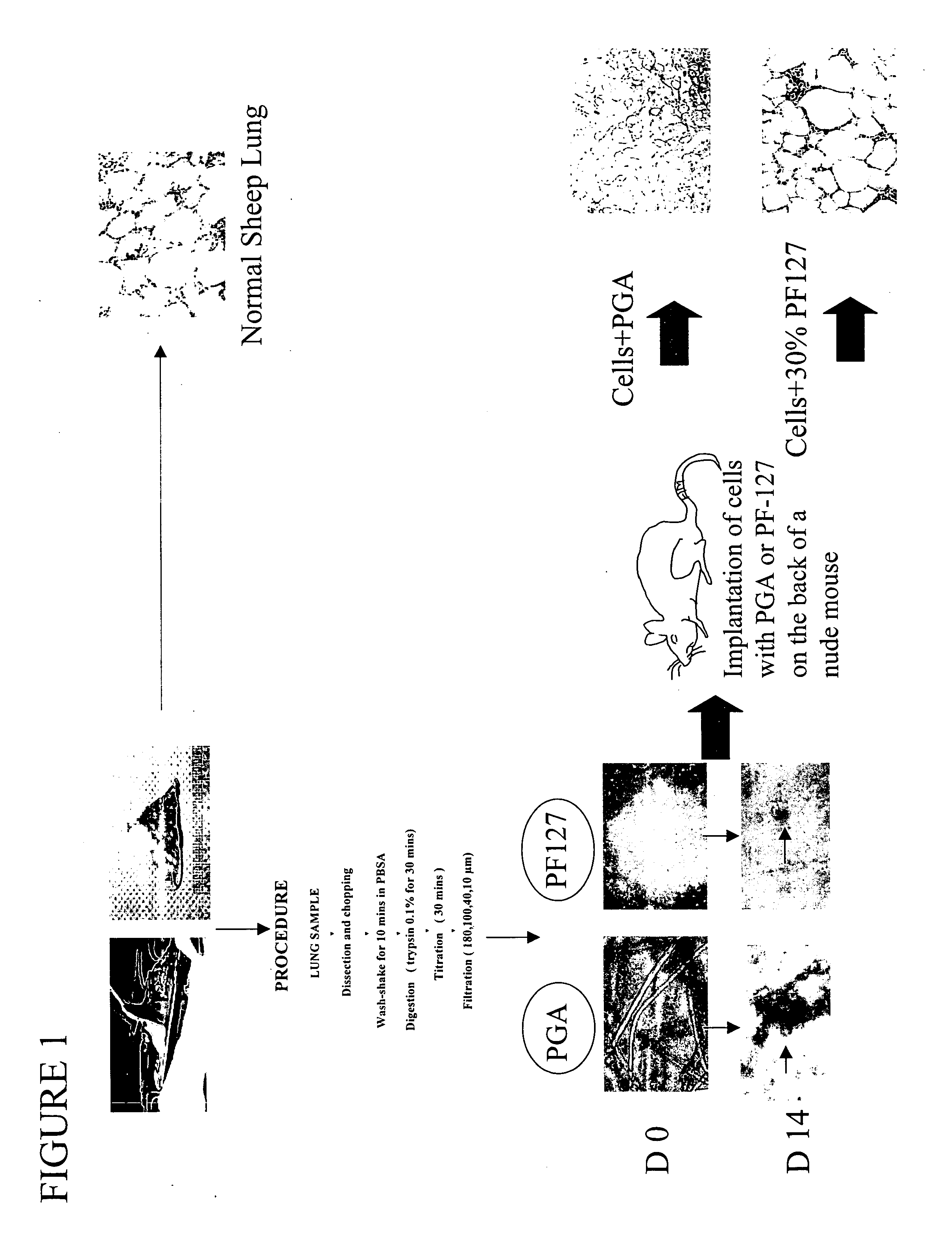 Engineered lung tissue, hydrogel/somatic lung progenitor cell constructs to support tissue growth, and method for making and using same