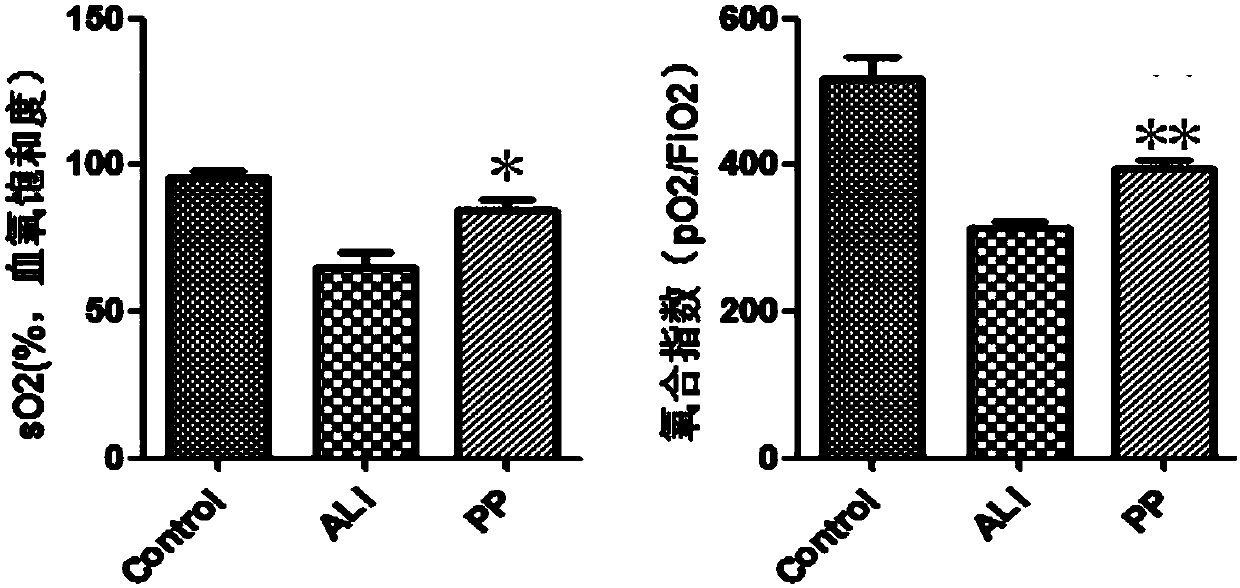 Application of placenta multipotential stem cell preparation in preparation of medicine for treatment of acute lung injury