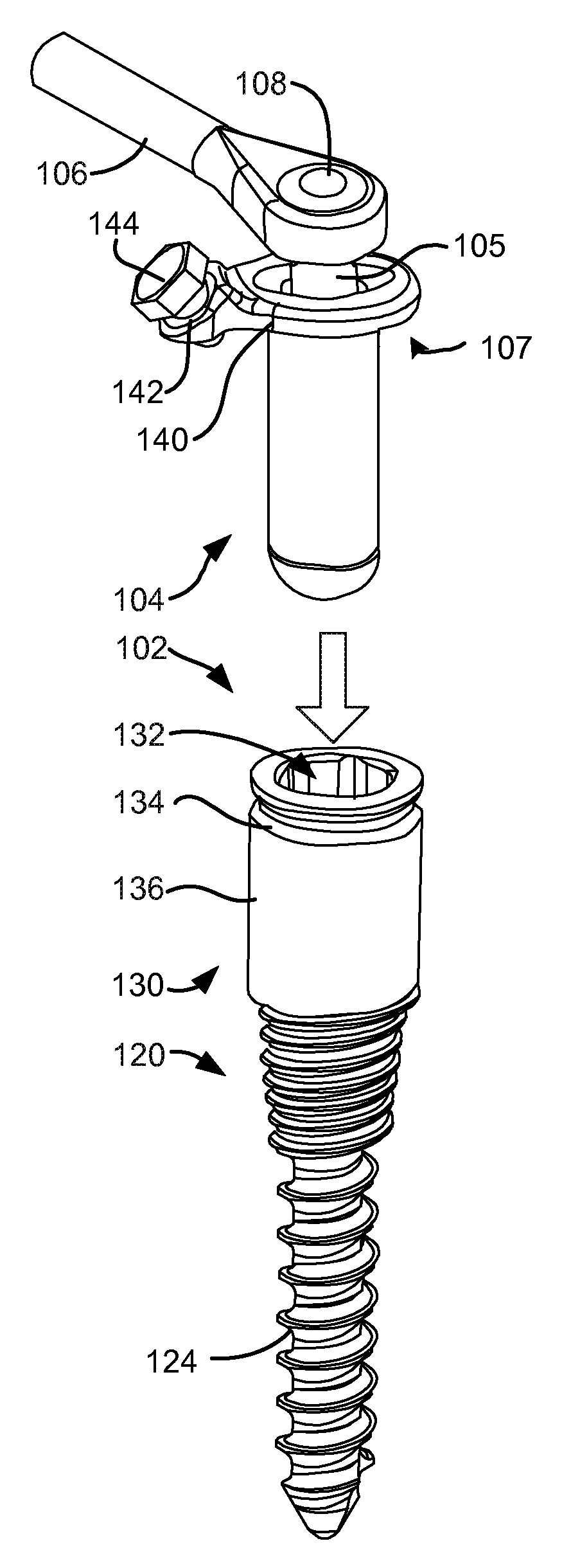 Load-sharing bone anchor having a durable compliant member and method for dynamic stabilization of the spine