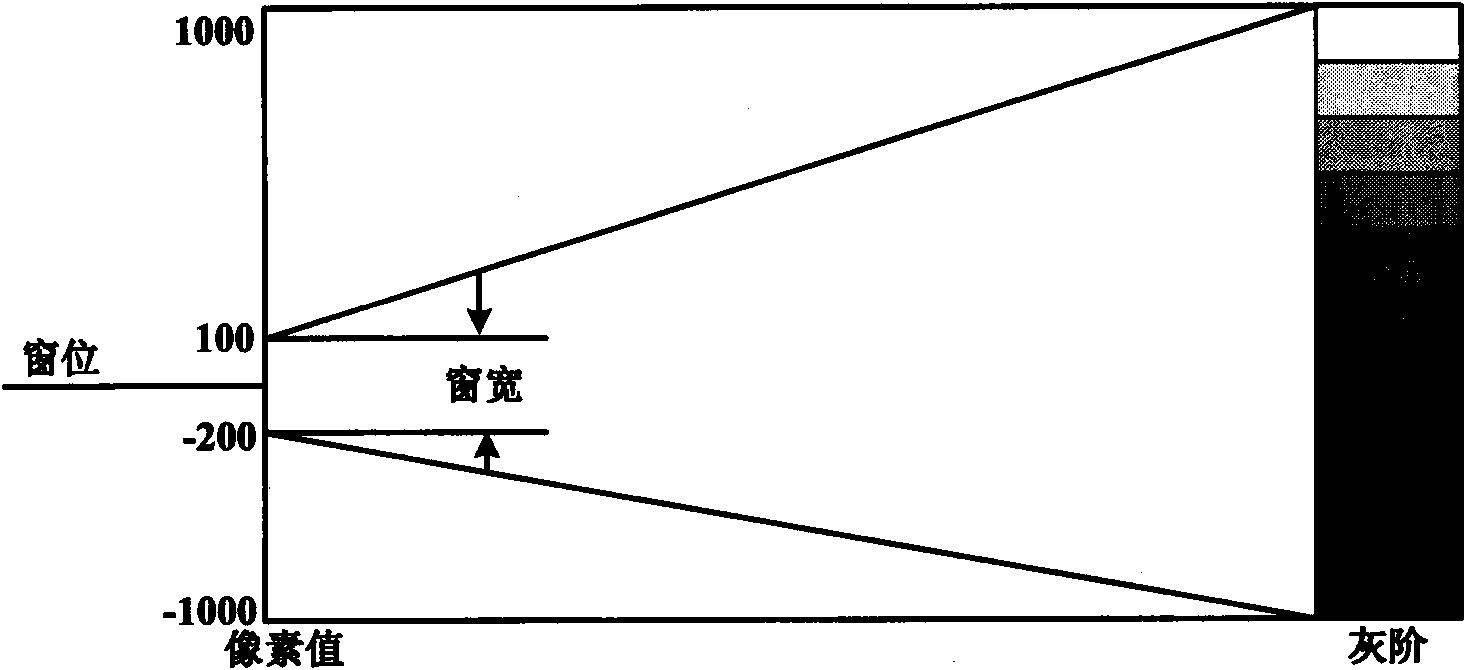 Method for displaying soft copy of mammary gland X-line graph