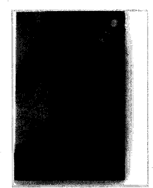 Method for displaying soft copy of mammary gland X-line graph
