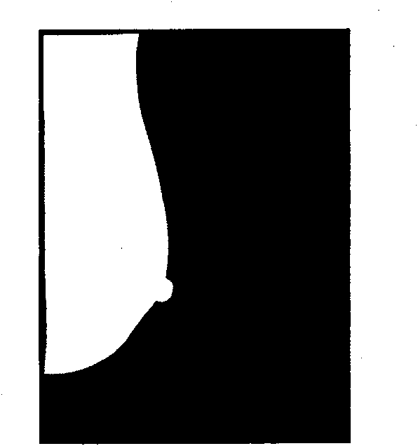 Method for displaying soft copy of mammary gland X-line graph