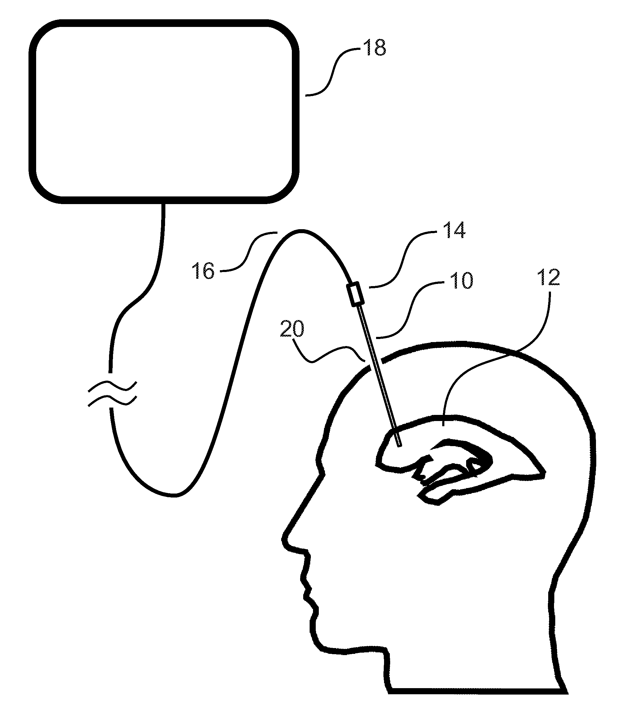 System and method for inserting intracranial catheters