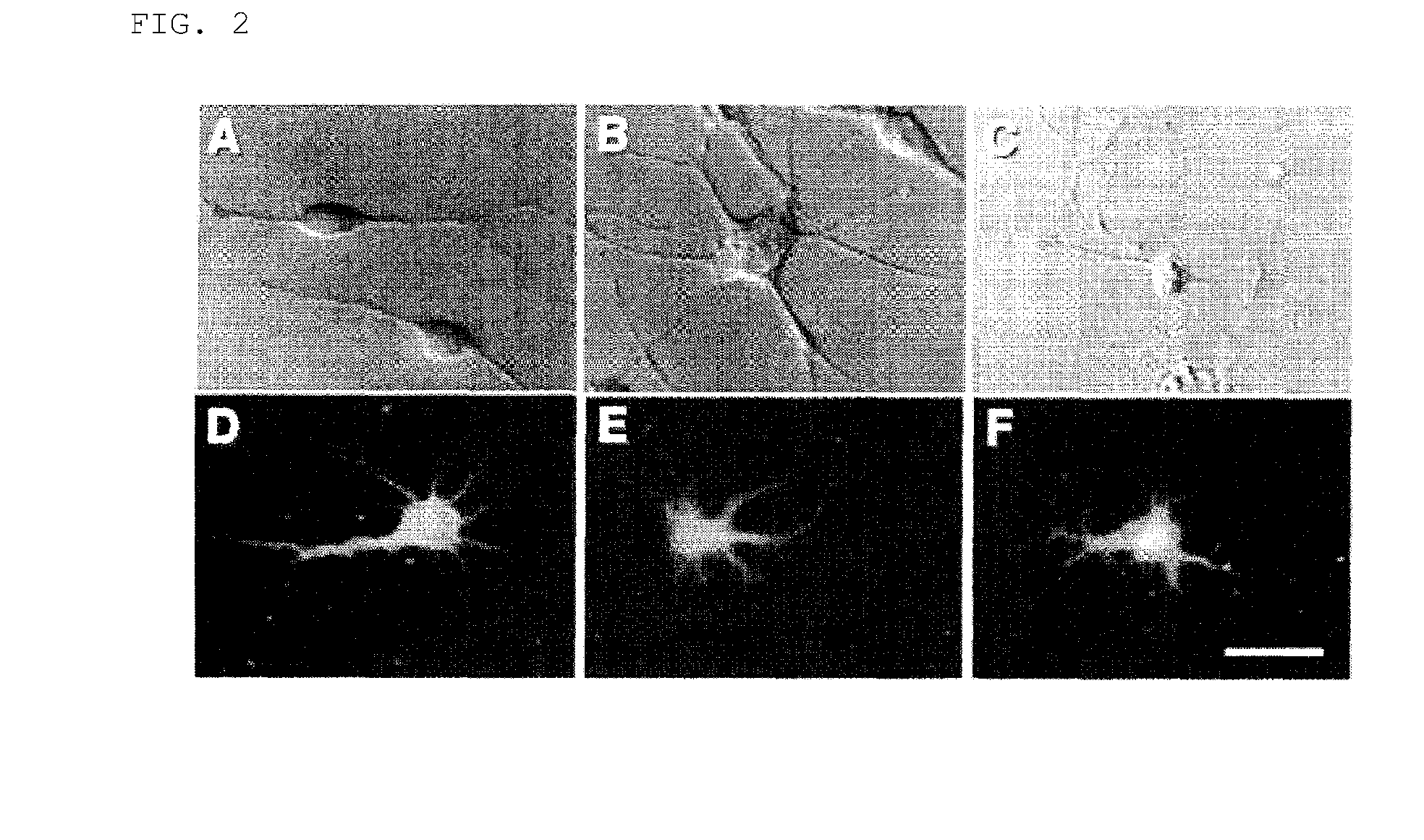 Method for inducing differentiation of mesodermal stem cells, es cells, or immortalized mesodermal stem cells into neural cells