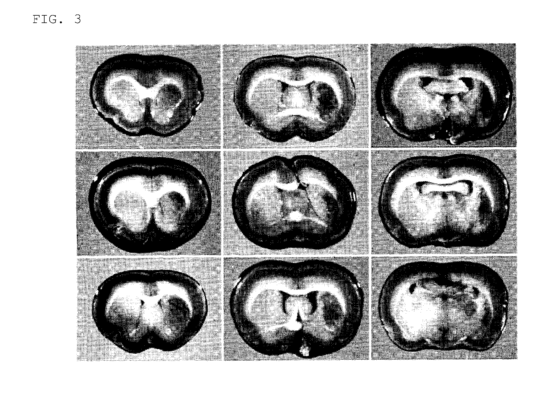 Method for inducing differentiation of mesodermal stem cells, es cells, or immortalized mesodermal stem cells into neural cells