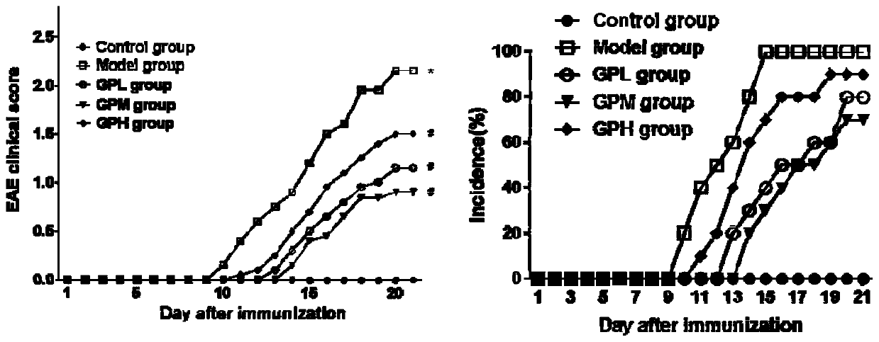 Application of gardenin in preparation of medicament for treating multiple sclerosis