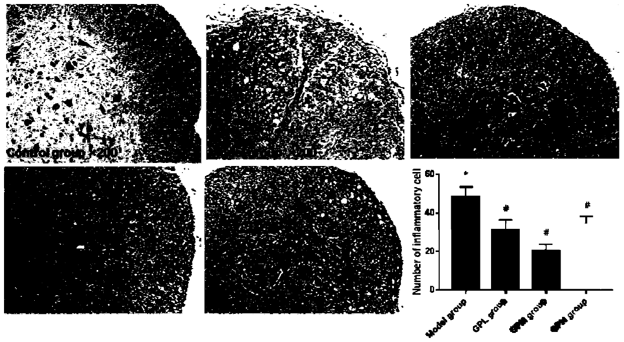 Application of gardenin in preparation of medicament for treating multiple sclerosis