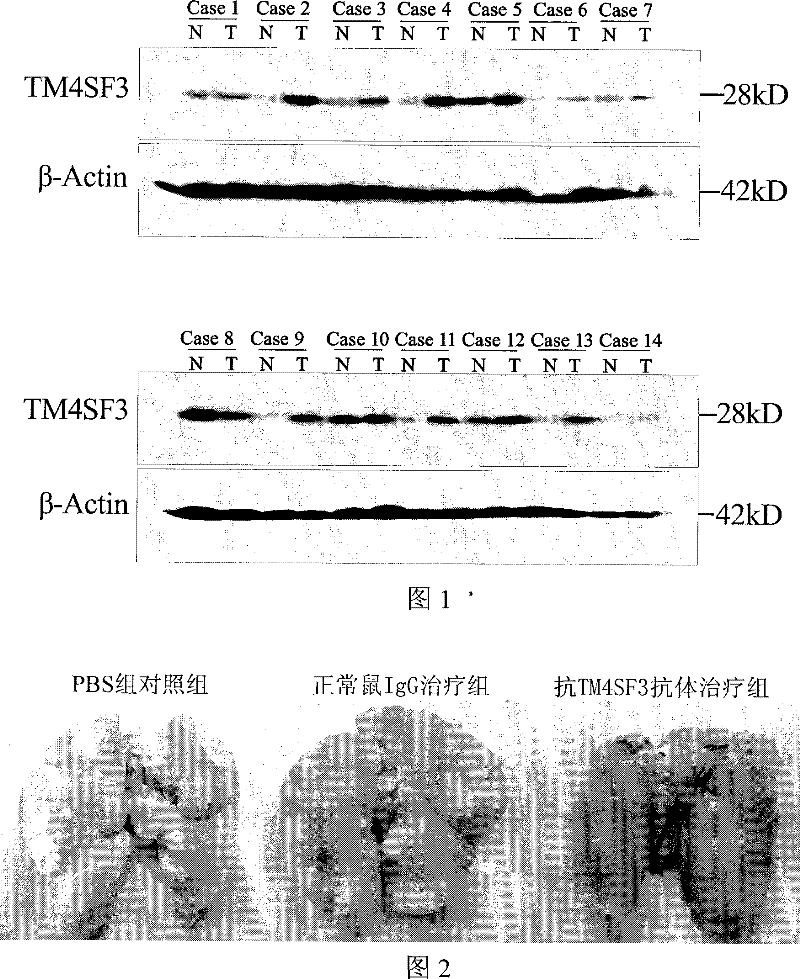 TM4SF3 protein for preparing antineoplastic antibody and use thereof