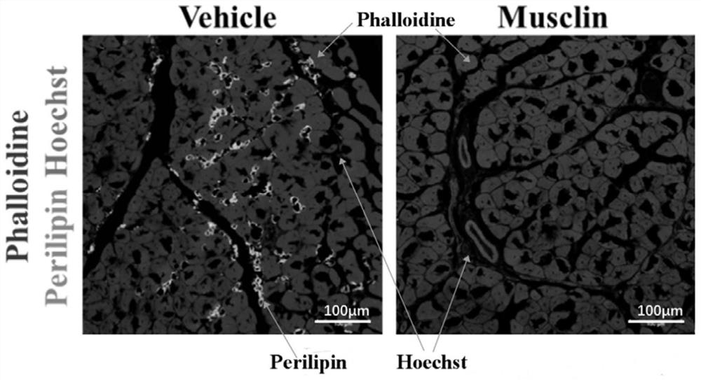 Application of musclin in preparation of drugs for inhibiting muscle adiposis, fibrosis and atrophy
