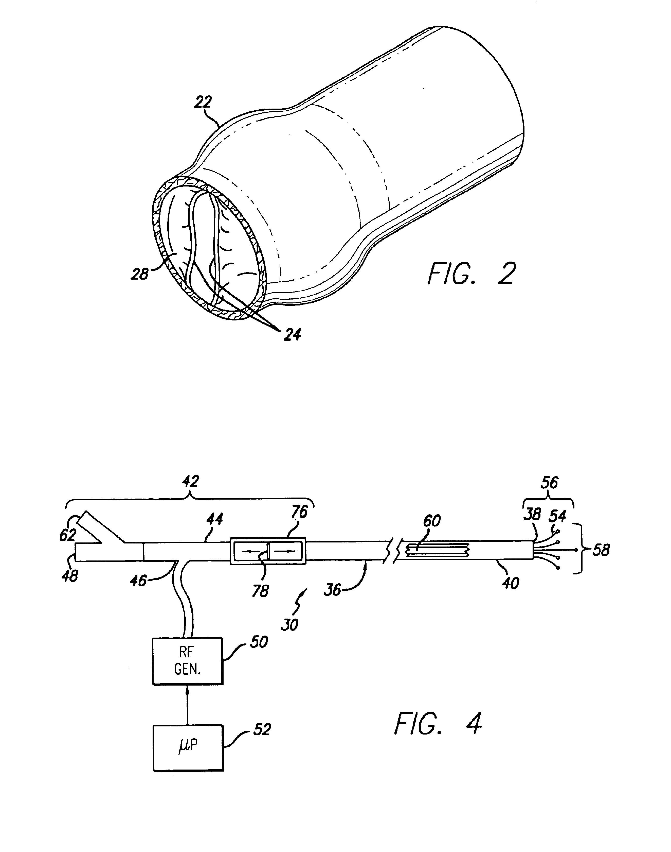 Apparatus for applying energy to biological tissue including the use of tumescent tissue compression