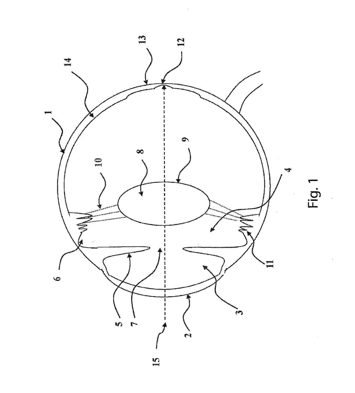 Intraocular lens system