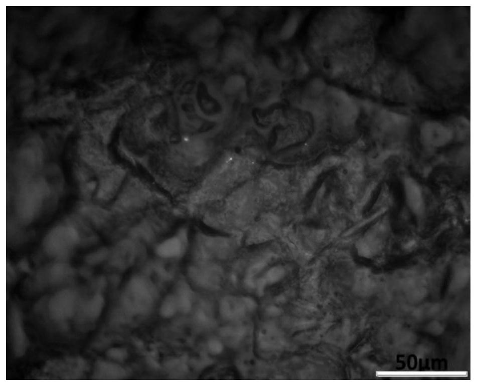 Aluminum alloy processing method, aluminum alloy and medical device resistant to high temperature and damp heat sterilization