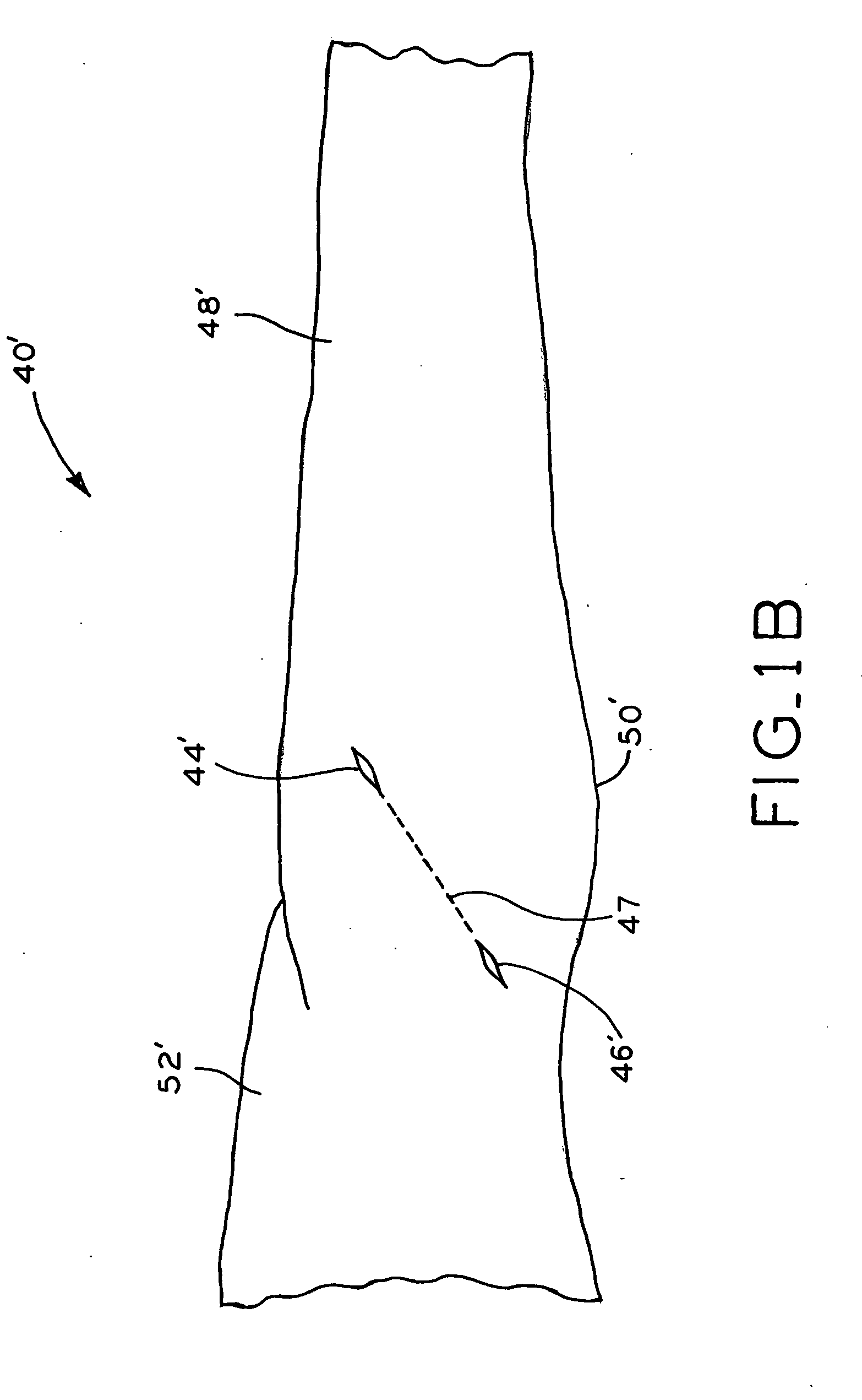 Method and apparatus for performing a minimally invasive total hip arthroplasty