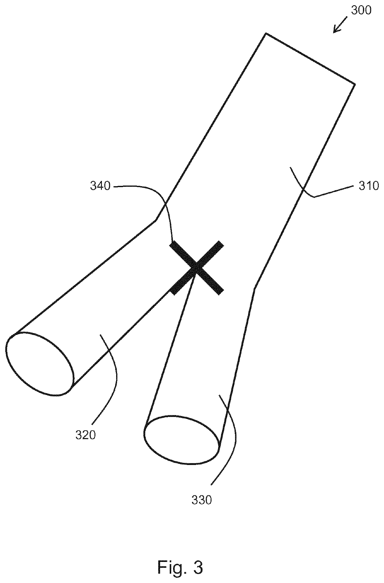 Imaging method, controller and imaging system, for monitoring a patient post evar