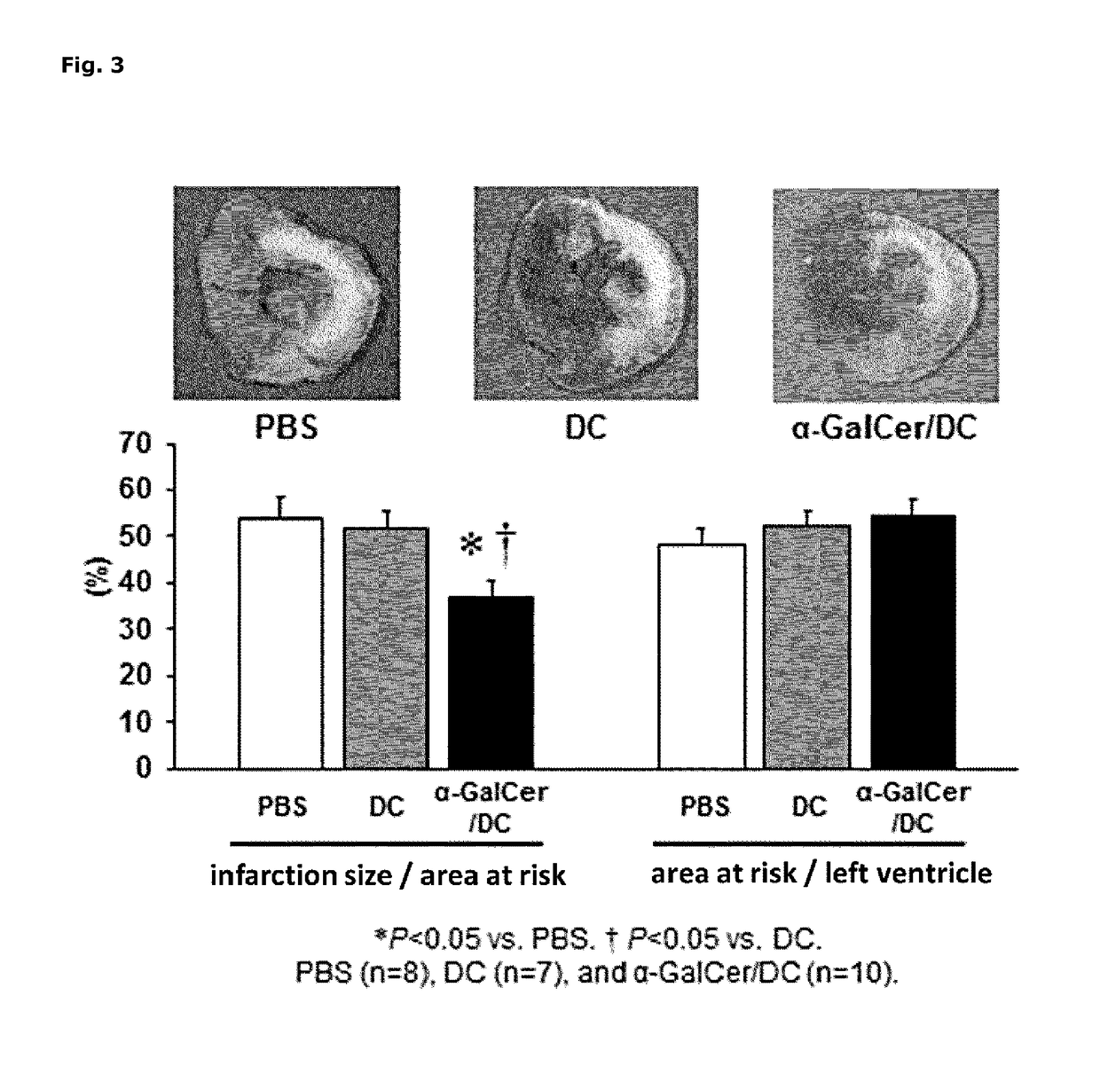 Pharmaceutical containing dendritic cells, and method for producing same