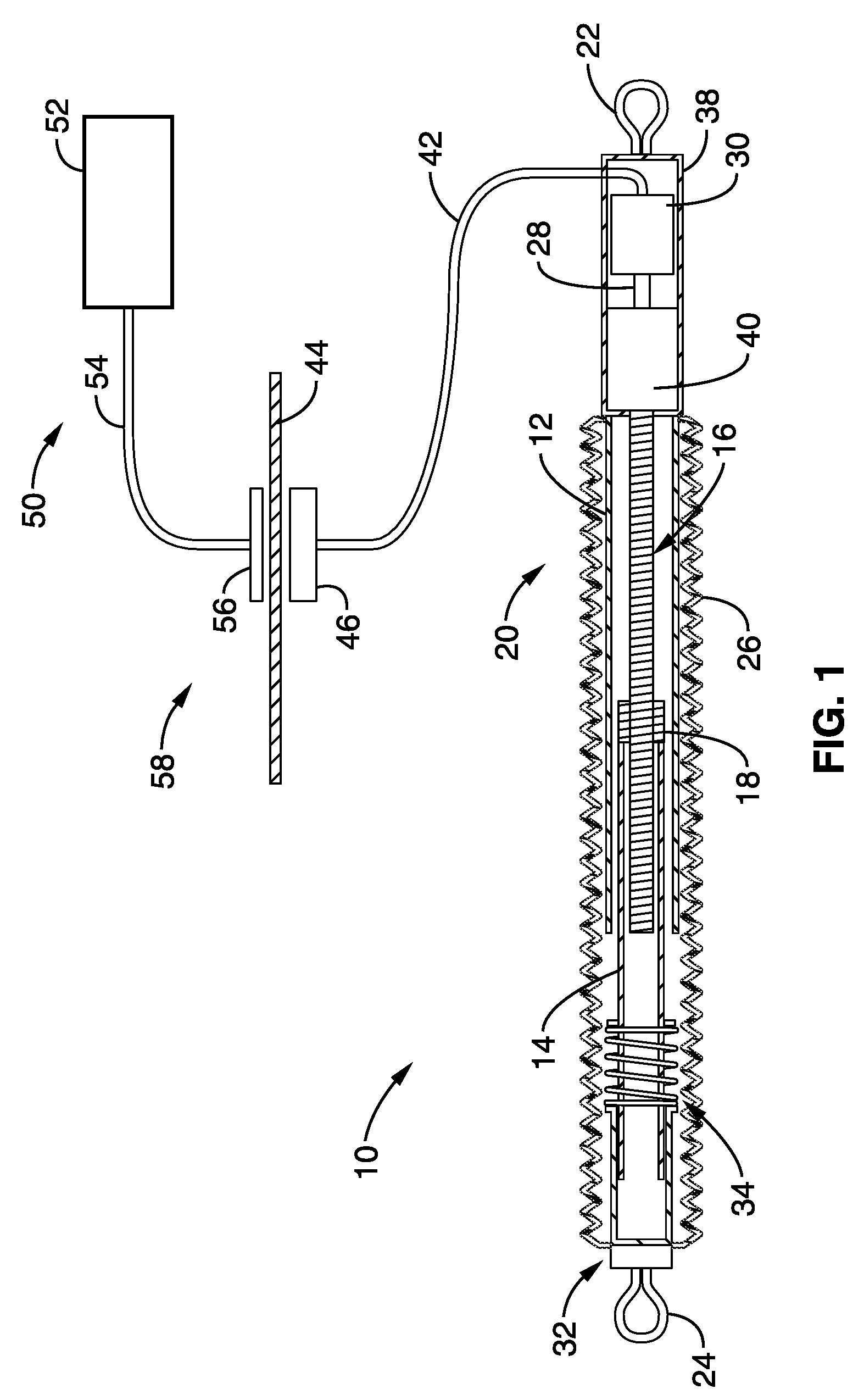 Apparatus and methods for alteration of anatomical features