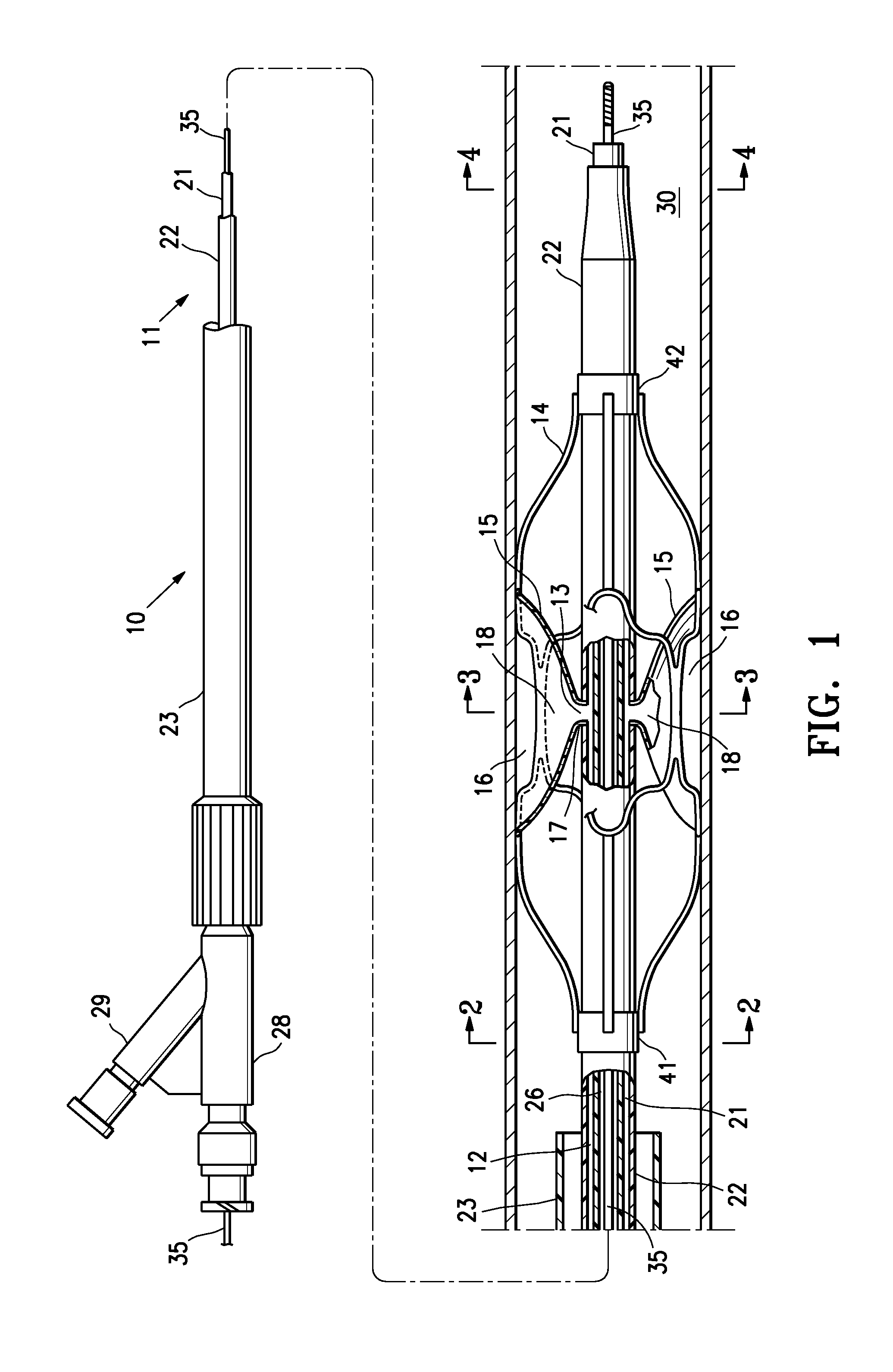Low profile agent delivery perfusion catheter having a funnel shaped membrane