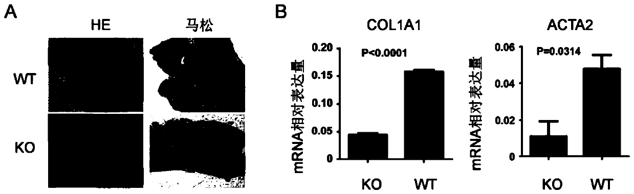 Application of CXCL16 protein and its monoclonal antibody in preparation of drugs to prevent and/or treat intestinal injuries