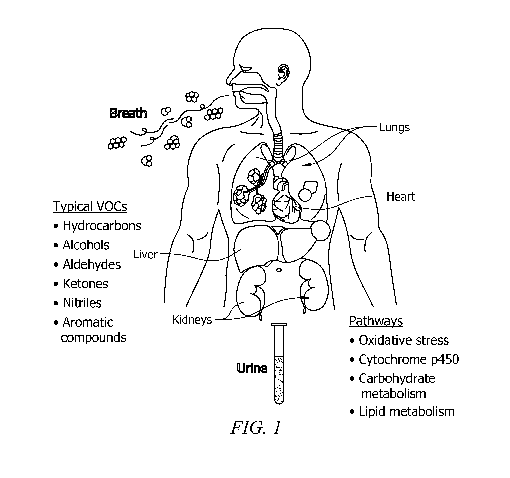 Volatile Organic Gases as Bioindicators for Transplant Rejection