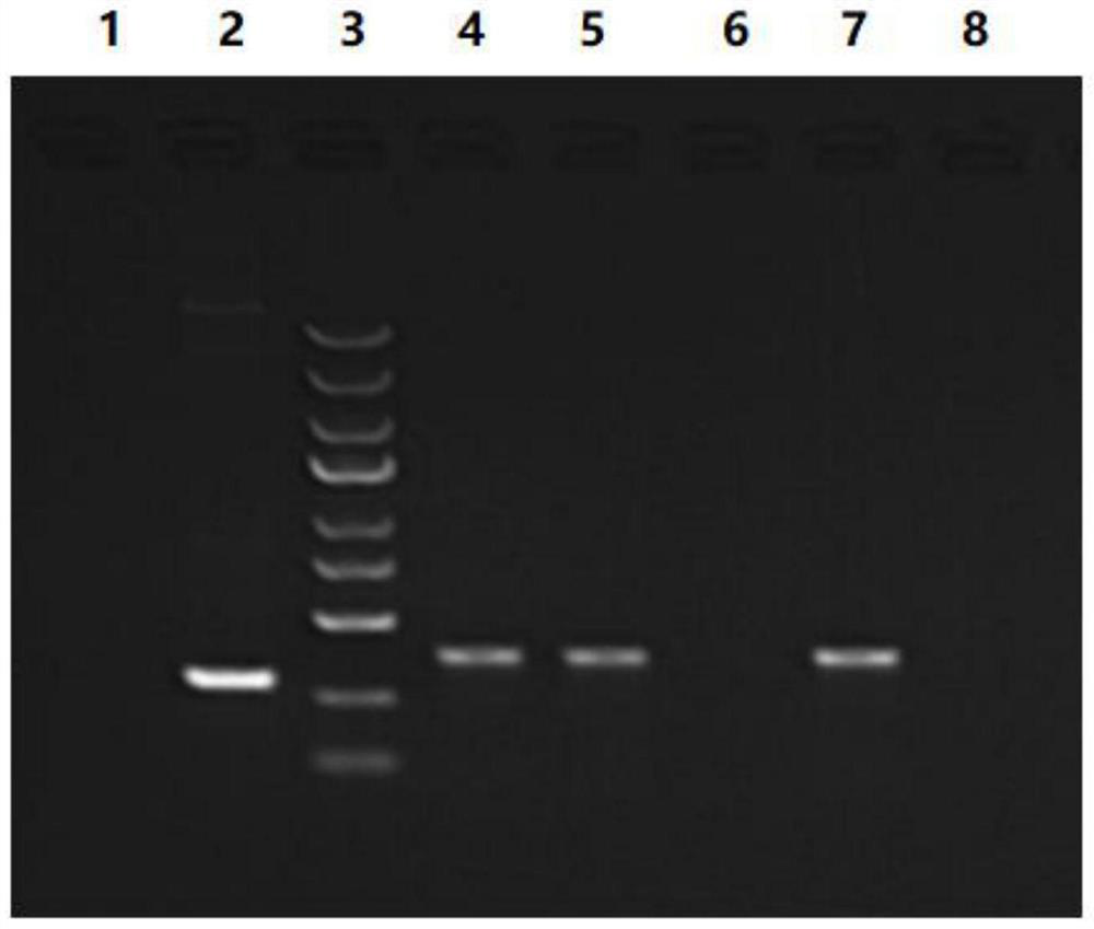 ShRNA (short hairpin ribonucleic acid) for knocking down PXYLP1 gene expression, lentiviral vector as well as construction method and application of lentiviral vector