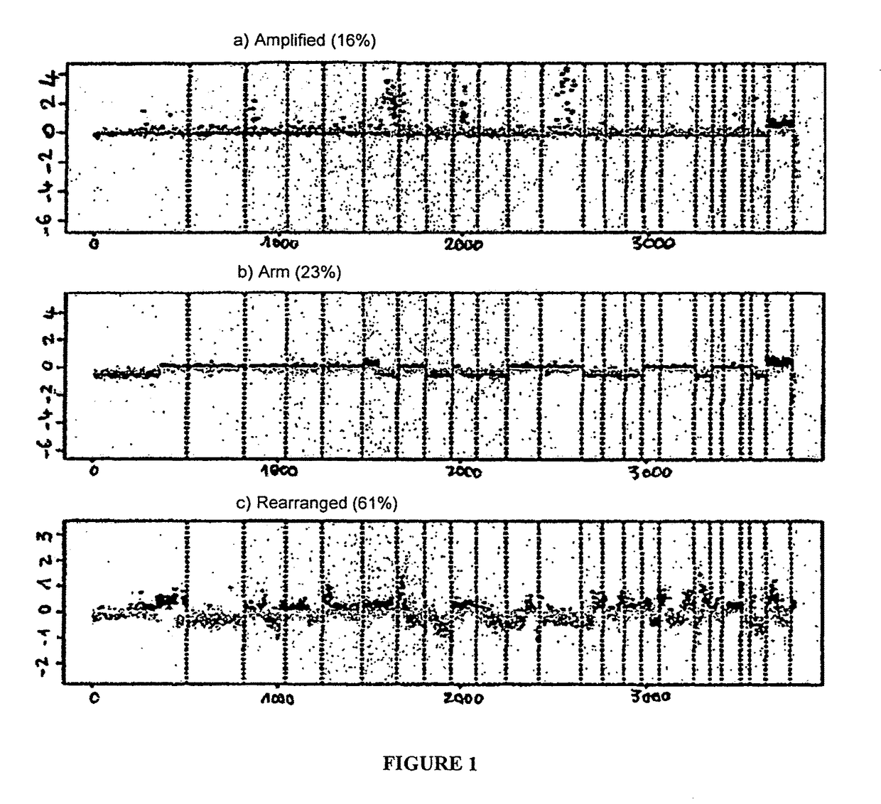 Prognostic molecular signature of sarcomas, and uses thereof